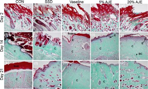 Histological Appearance Of Scald Wounds Stained With Masson Goldner