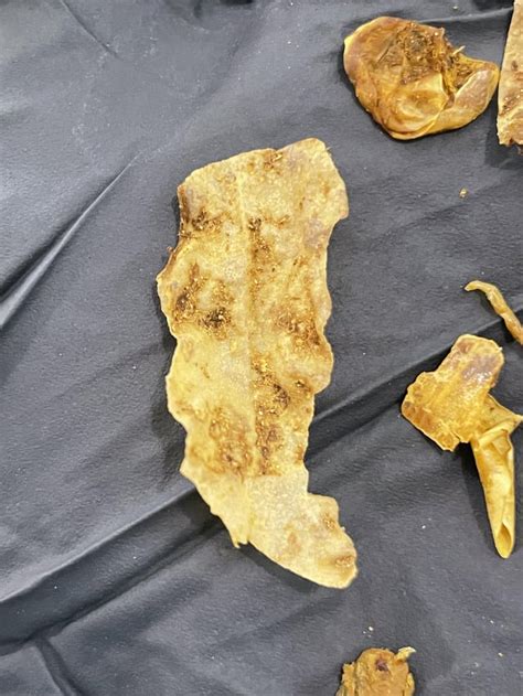 dead liver flukes in stool? : r/ClinicalMicrobiology