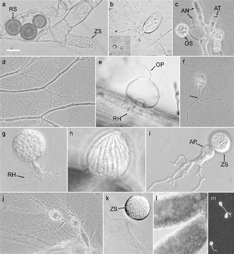 Phylum Chytridiomycota