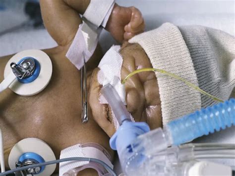 Good news for parents: Many preemie babies grow up fine