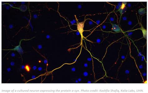 Neuron [image] Eurekalert Science News Releases