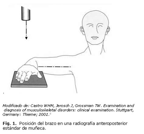 Método para el cálculo de las medidas angulares de la articulación del