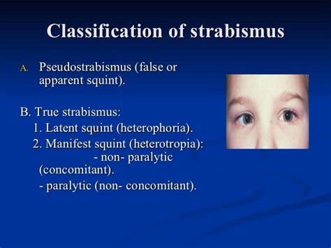 Diagnosis evaluation in strabismus