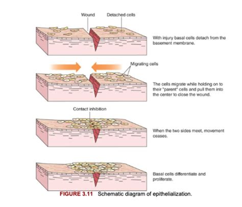 Wound Healing And Wound Staging Flashcards Quizlet