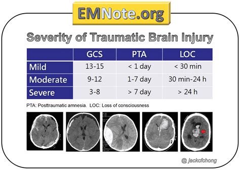 EMNote.org - EMNote