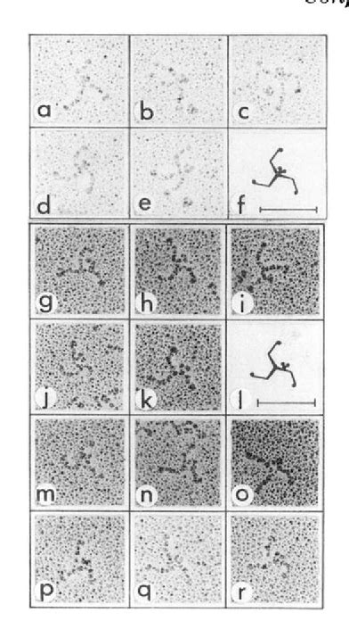 Figure From Immunoelectron Microscopic Evidence For The Extended