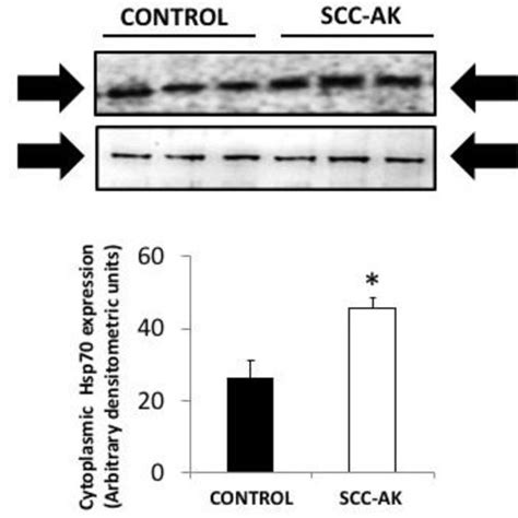 Representative Western Blot Experiments Showing The Expression Of Hsp70 Download Scientific