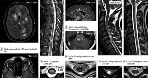 Representative Examples Of Magnetic Resonance Imaging Mri Findings In