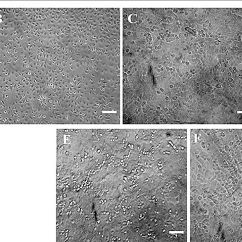 Dose Dependent Inhibition And Morphological Alterations Of Mcf 7 Cells Download Scientific