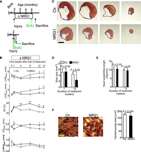 Neuregulin1erbb4 Signaling Induces Cardiomyocyte Proliferation And