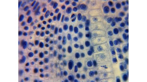 Solved Locate a cell undergoing the G2 phase of | Chegg.com