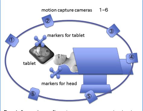 Pdf The Trans Visible Navigator A See Through Neuronavigation System