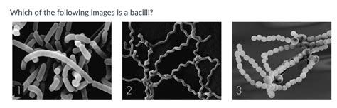 Solved Which of the following images is a bacilli? | Chegg.com