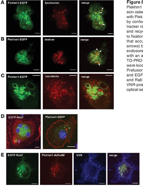 Figure 8 From Involvement Of PLEKHM1 In Osteoclastic Vesicular