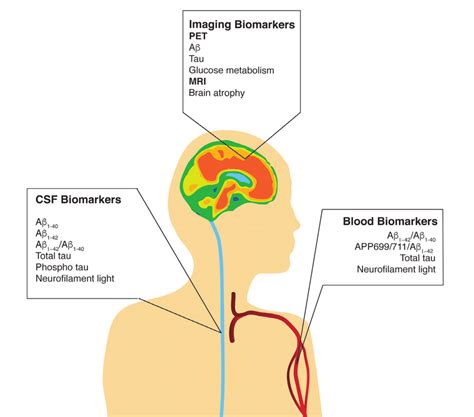 Fluid And Imaging Biomarkers In Alzheimers Disease A Schematic