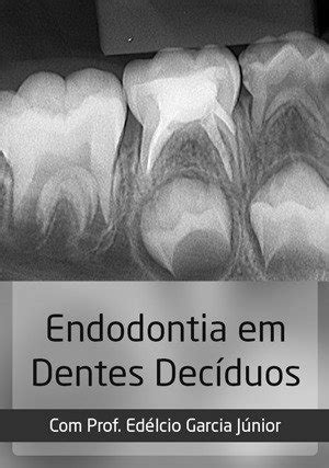 Assista Online Endodontia Em Dentes Dec Duos Ident