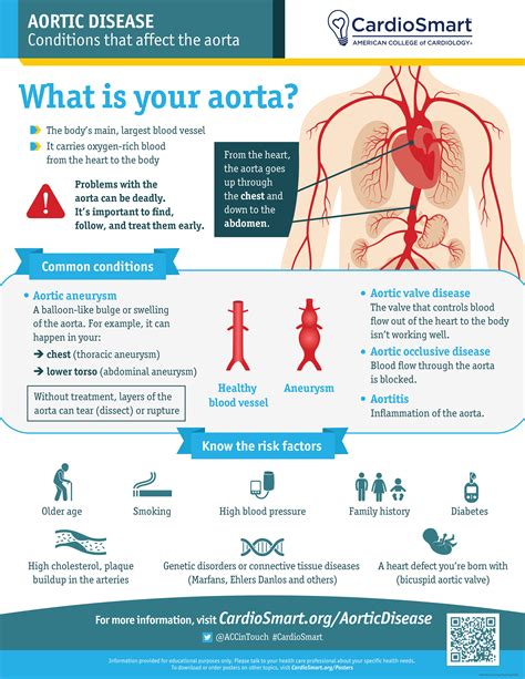 Infographic Conditions That Cause Aortic Disease Doctors Without Waiting Rooms