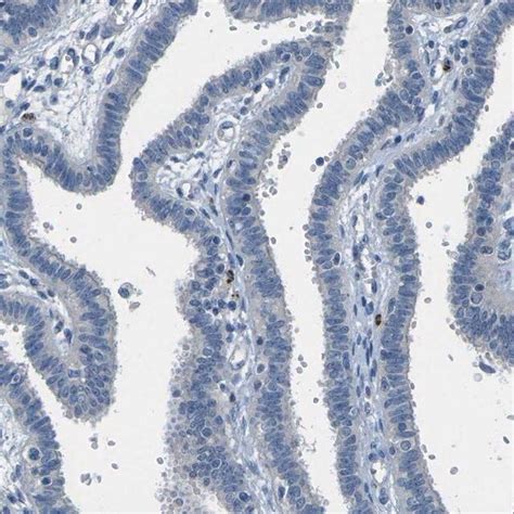 Anti CYP2C8 Antibody Produced In Rabbit