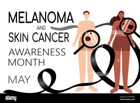 Melanoma And Skin Cancer Awareness Month Vector Illustration Stock