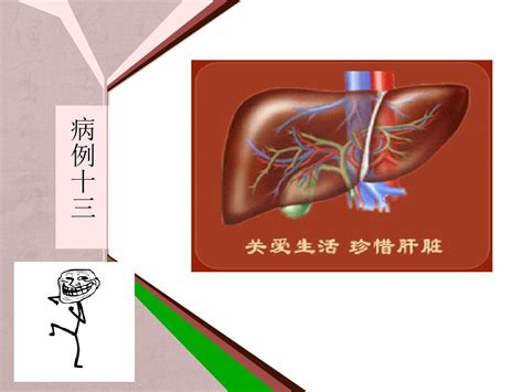 病例ppt课件word文档免费下载亿佰文档网