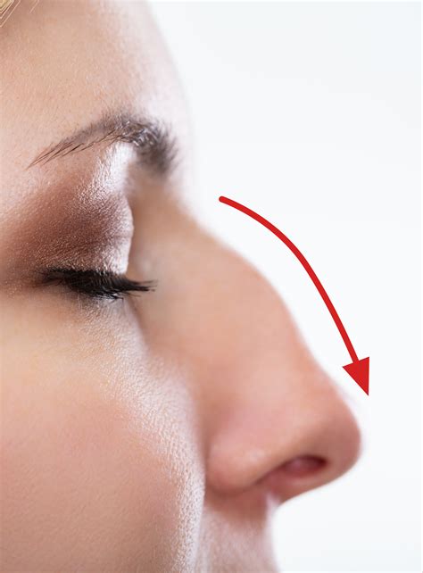 Get Rid Of Bumps On Nose Get Rid Of Bumps