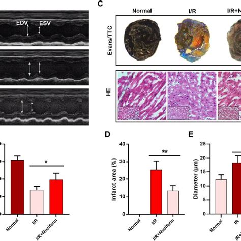 Nuciferine Improves Cardiac Function And Reduces Myocardial Infarction