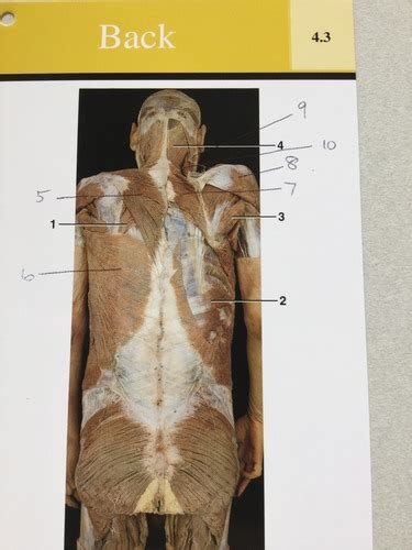 Back Structures W Cadaver Pics Flashcards Quizlet