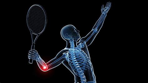 5 At Home Exercises For Tennis Elbow Lateral Epicondylitis