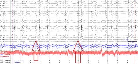 Gallery The Eeg Game