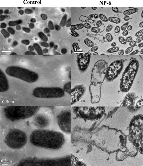 Transmission Electron Microscopy Images Of E Coli Treated And