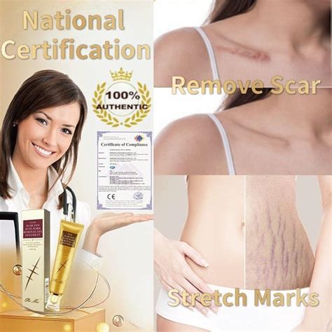 The New 2022 Scar Remover Gel Stretch Mark Removal Acne Removal Cream