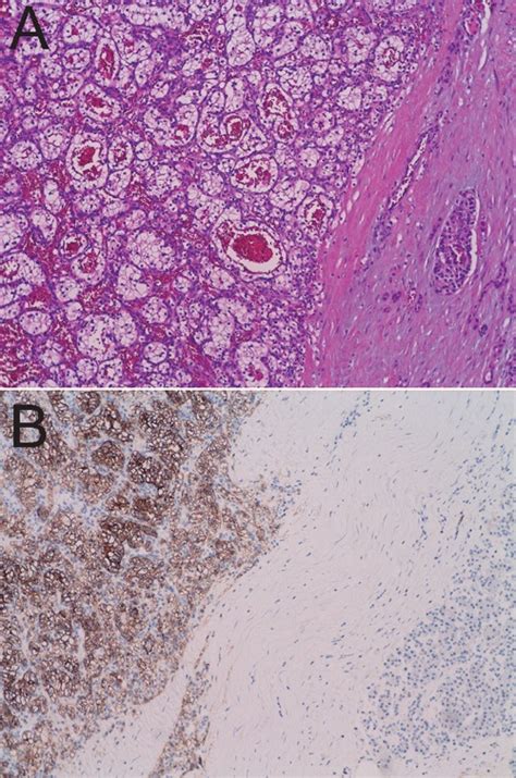 A Hematoxylin Eosin Stained Medium Power Image Of The Pancreatic