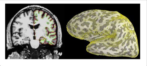 Table From Meg And Eeg Data Analysis With Mne Python Semantic Scholar