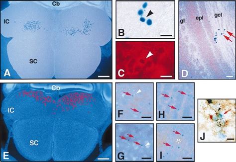 A D Transplant Of Postnatal Xlacz Svz Cells Into The Ventricle Of