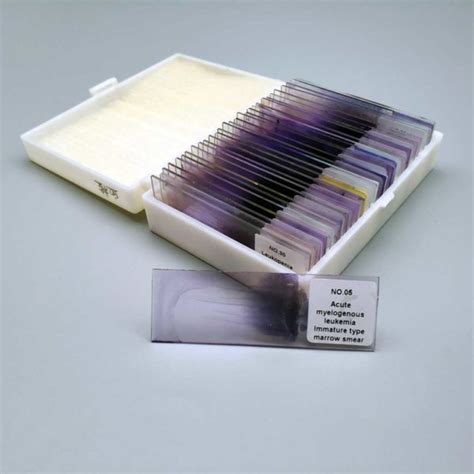 30pcs hematology slides for medical students - Xinxiang Happy Science ...