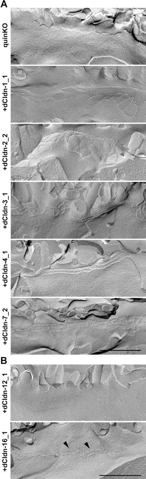 Freeze Fracture Replica Images Of Claudin Quinko Cells And Claudin