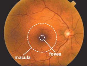 Macular Degeneration | Eye Center of Texas