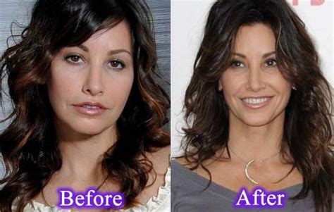 Gina Gershon Gina Gershon Plastic Surgery Beauty