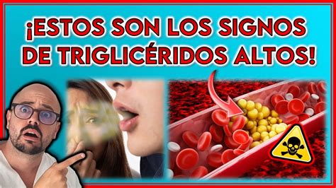 Se Ales Reveladoras De Trigliceridos Altos Signos Que No Debes