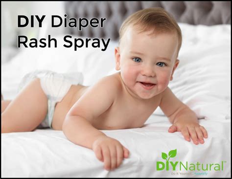 Diaper Rash Spray A Natural Diy Spray That Works And Leaves No Mess