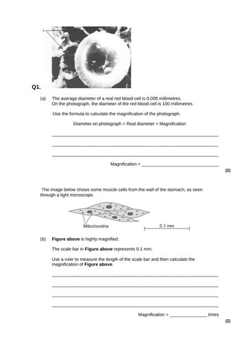 Electron microscopes and magnification | Teaching Resources