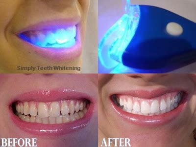 Geo Led Clareamento Dental A Led