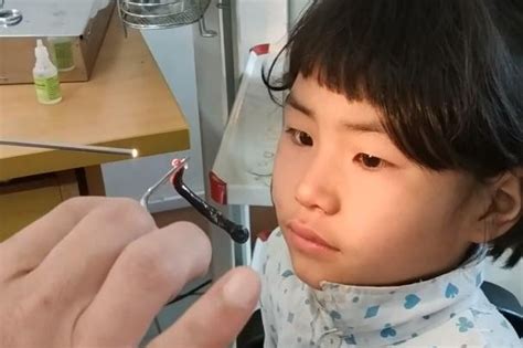 Watch Doctor Removes Leech From 6 Year Old Girls Nose