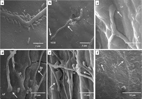 Scanning Micrographs Showing Colonization Of Rice Husk By Fusarium