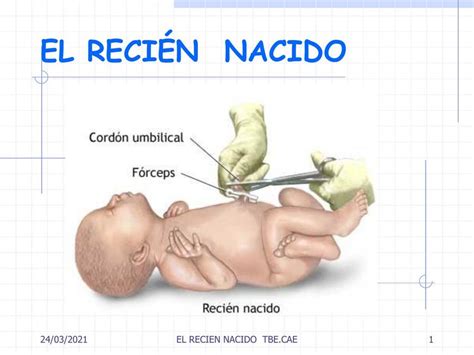 El Recién Nacido Cristina Martin uDocz