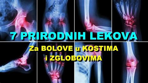 7 PRIRODNIH LEKOVA Za BOLOVE U KOSTIMA I ZGLOBOVIMA YouTube