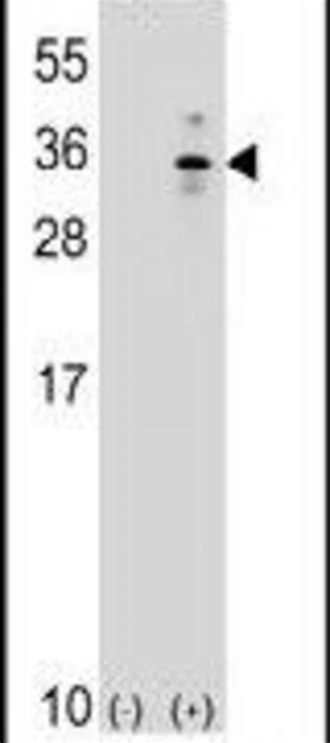 Xbp Polyclonal Antibody Invitrogen L Unconjugated Fisher