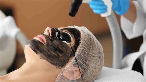 Peeling facial en Querétaro Dra Serrano