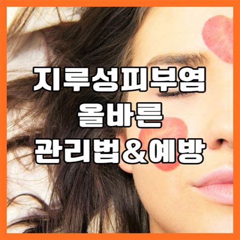 지루성 피부염 올바른 관리법과 예방