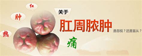 手术治急性肛周脓肿 肛周脓肿是什么原因导致【健康新闻】福州肛肠医院福州医博肛肠医院